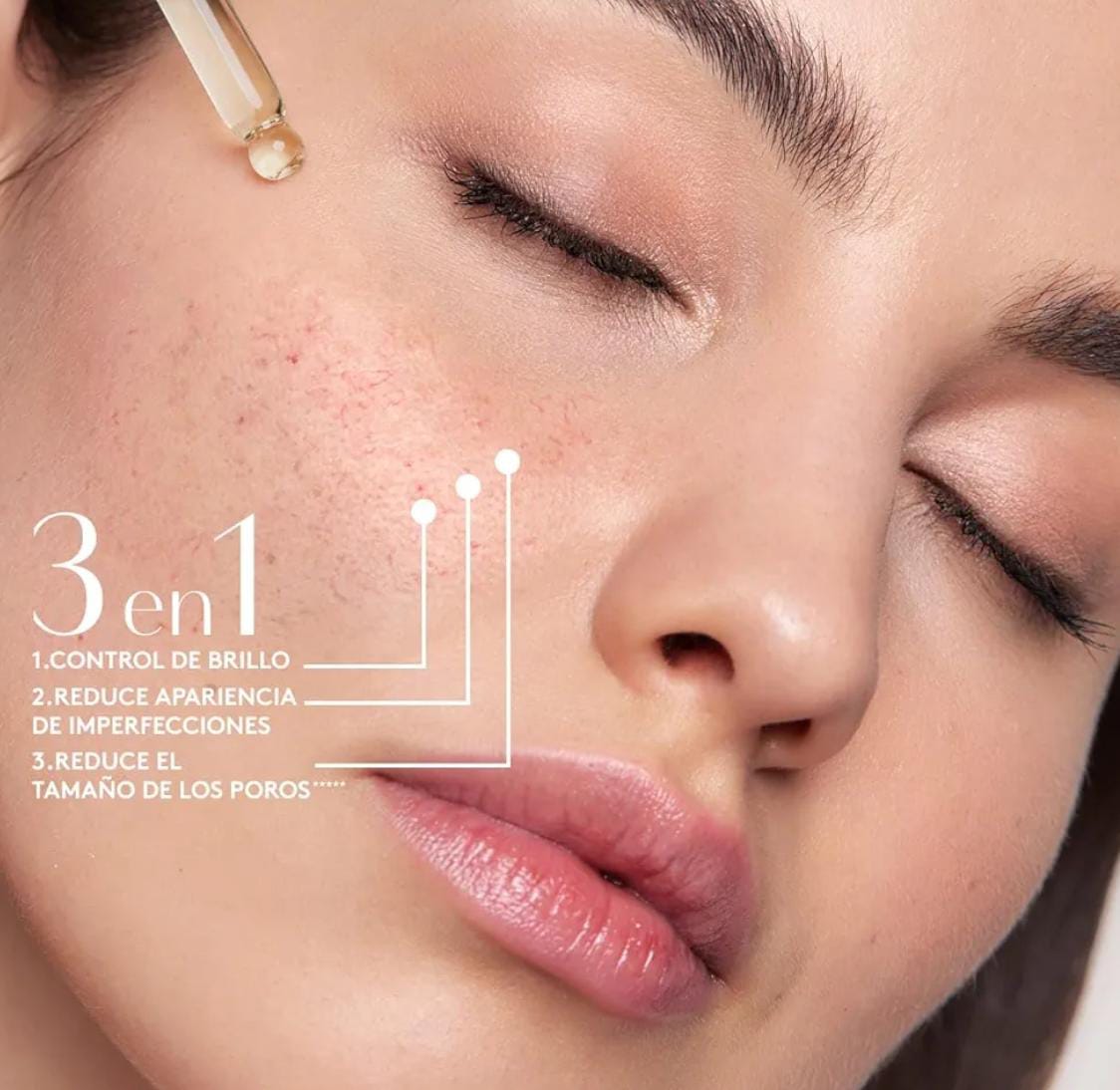 Suero Anti-Imperfecciones Ésika