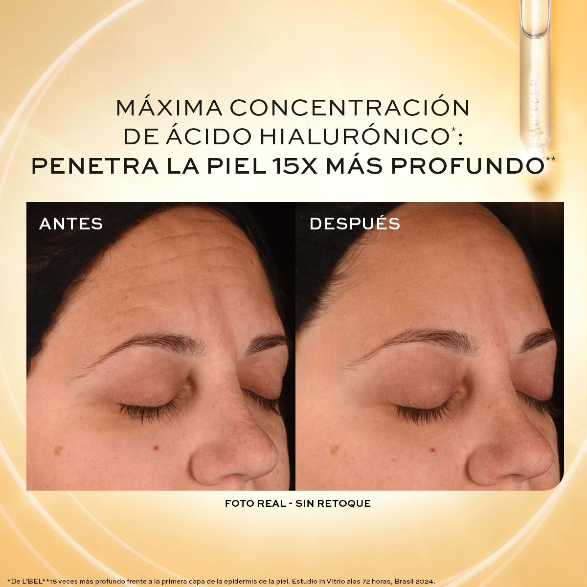 SUERO REDUCTOR DE ARRUGAS