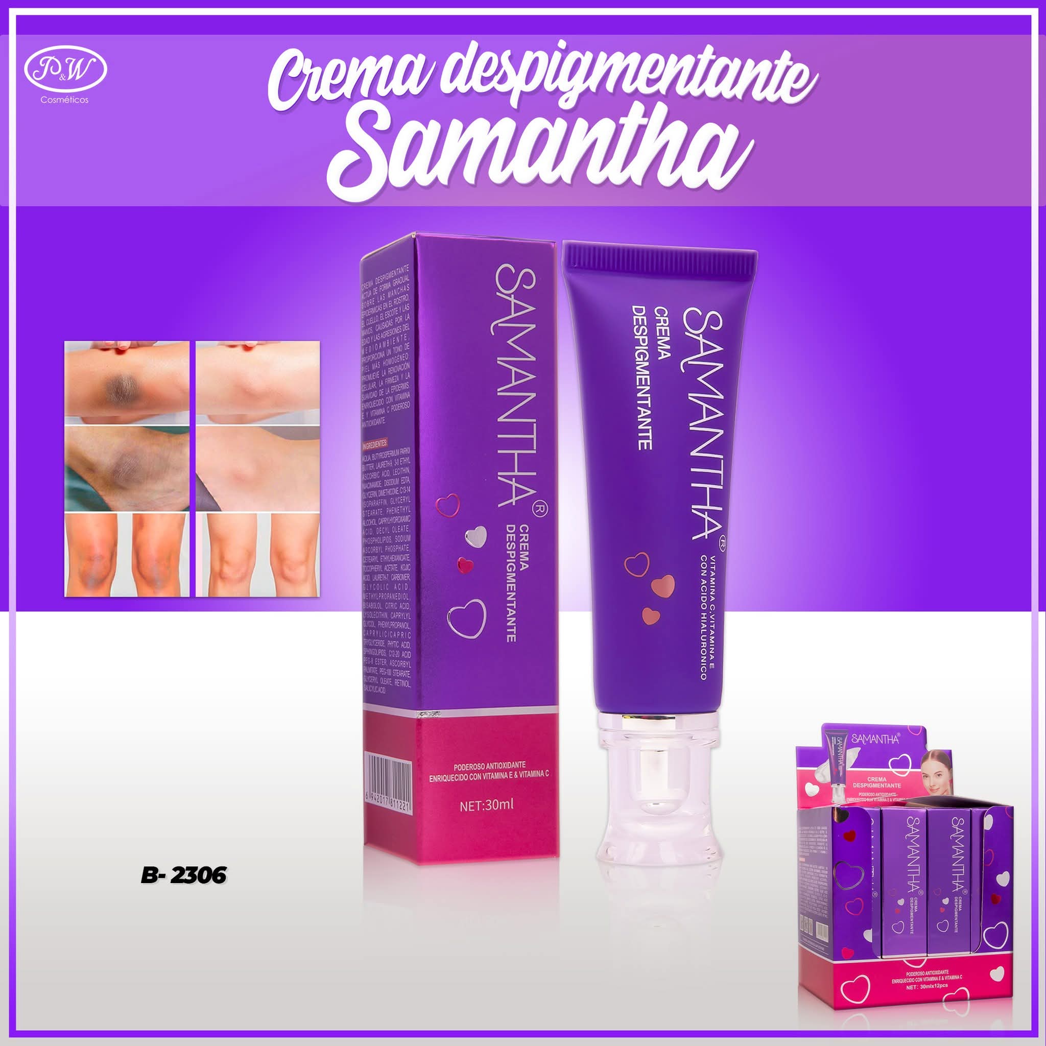 CREMA DESPIGMENTANTE SAMANTHA